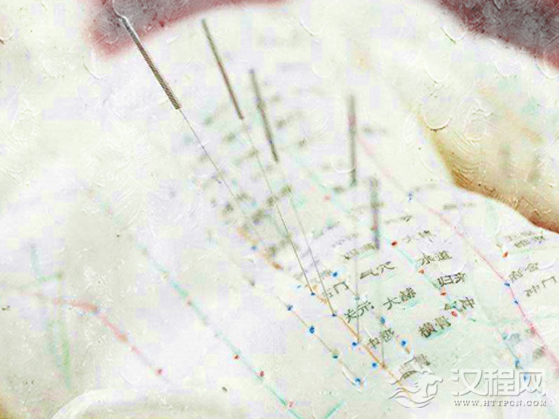 针灸.jpg 针灸.jpg