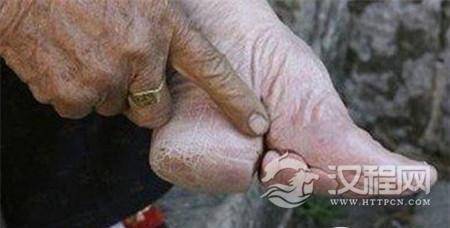 1485159402445292.jpg 9273b73d232143898a75cda7c7bd17cd_th.jpg