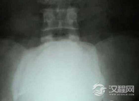 1524128814100251.png image.png