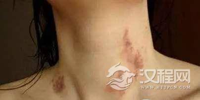 1517966753140489.png blob.png