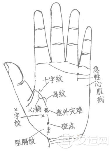 生命线十字纹、星纹、斑点、岛纹算命