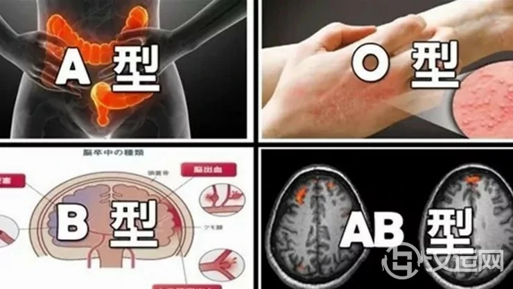 血型之中暗藏你的健康密码,看看你容易得什么病! 血型之中暗藏你的健康密码,看看你容易得什么病!