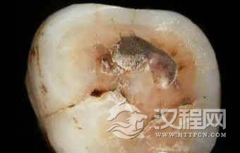 法国考古惊现56万年前人类牙齿