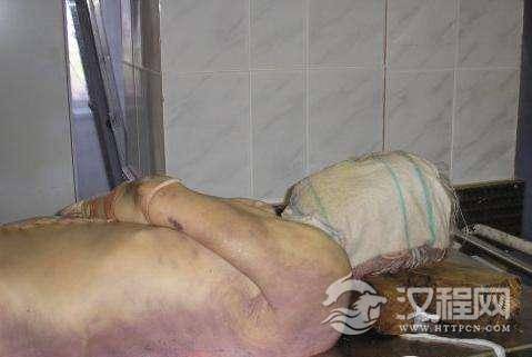 人死后多长时间出现尸斑？多长时间出现尸僵？真实尸斑图片【恐怖】