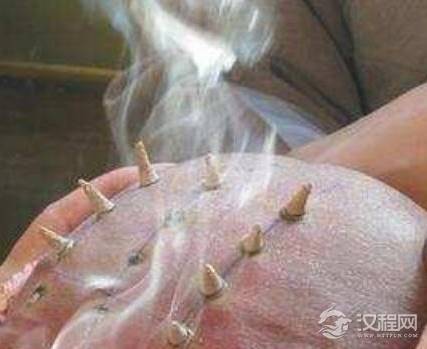 古代和尚为何要在头上烧戒疤 其实里面是有故事的