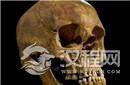 惊人发现！千年木乃伊头颅中竟残留取脑棒