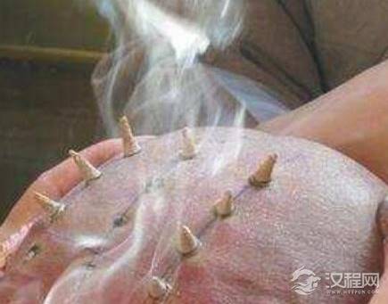 古代和尚为什么要烧戒疤 这东西真的是一排排的吗