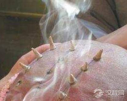 古代和尚头上为什么要烧戒疤 这东西有什么讲究吗