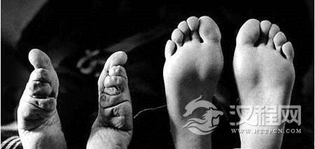 女子缠足