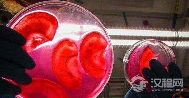 毛骨悚然!一位加拿大科学家用苹果作为细胞培养基,培育出了人的“耳朵”