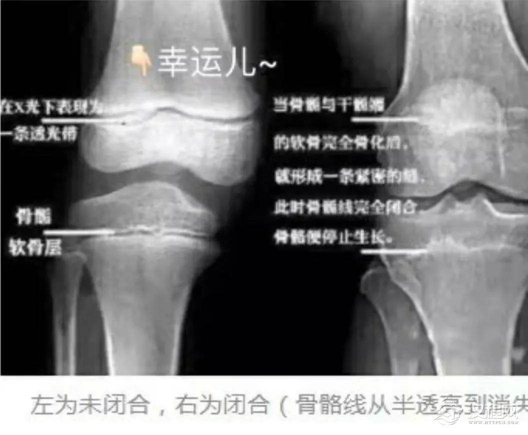 正在为长高发愁的舞蹈生，需要知道这些！