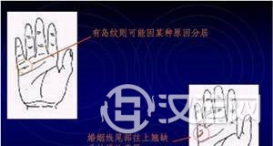 手掌纹与健康，看手掌纹知健康