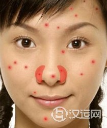 痘痘告诉你哪里生病了，脸上长痘痘怎么调理
