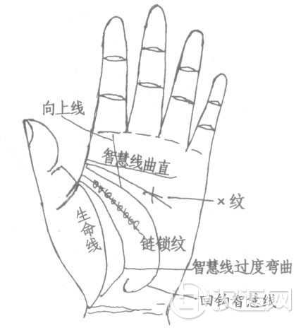 智慧线弯曲度、链锁状纹、X纹