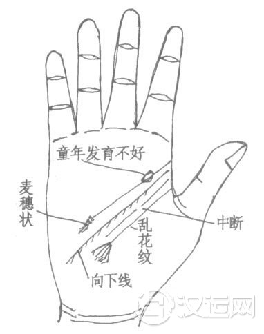 手相智慧线图解：智慧线下垂、智慧线岛纹、智