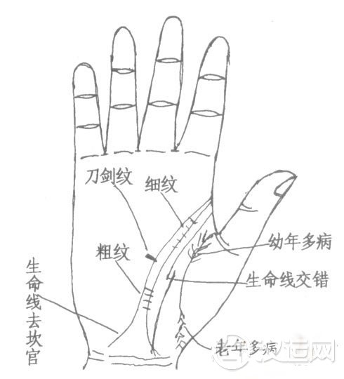 手相生命线断开、岛纹、三角纹，手上的生命线