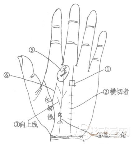 命运线断裂、命运线分叉、三角纹、星纹手相分析