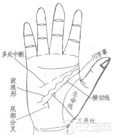 智慧线三角纹者、弯曲者、中断、链锁状纹图解