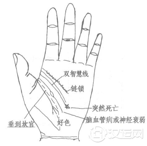 智慧线图解：智慧线分叉、智慧线末端分叉断开