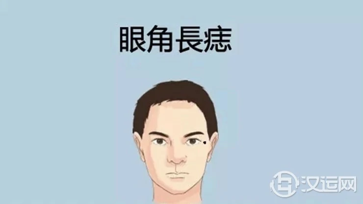 身体有这5颗痣，是做生意的好手！
